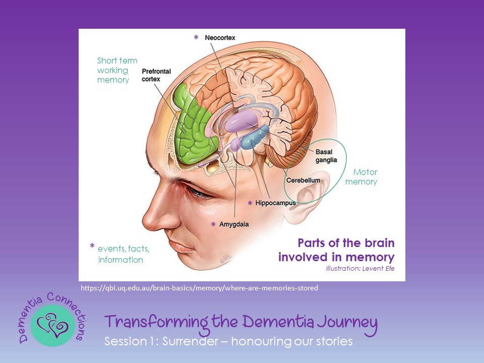 Dementia Workshop
